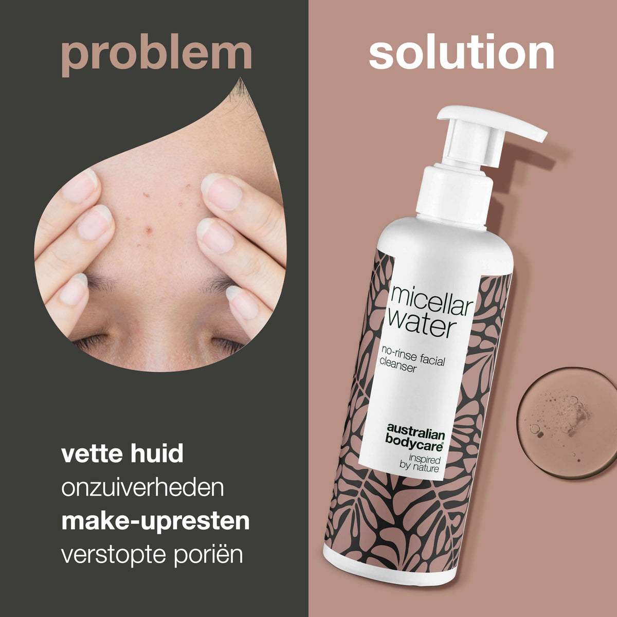 Micellair Water – Effectieve Reiniging voor Vette en Onzuivere Huid — Micellair Water verwijdert make-up, vuil en overtollig talg. Perfect voor dagelijkse reiniging en een frisse huid.