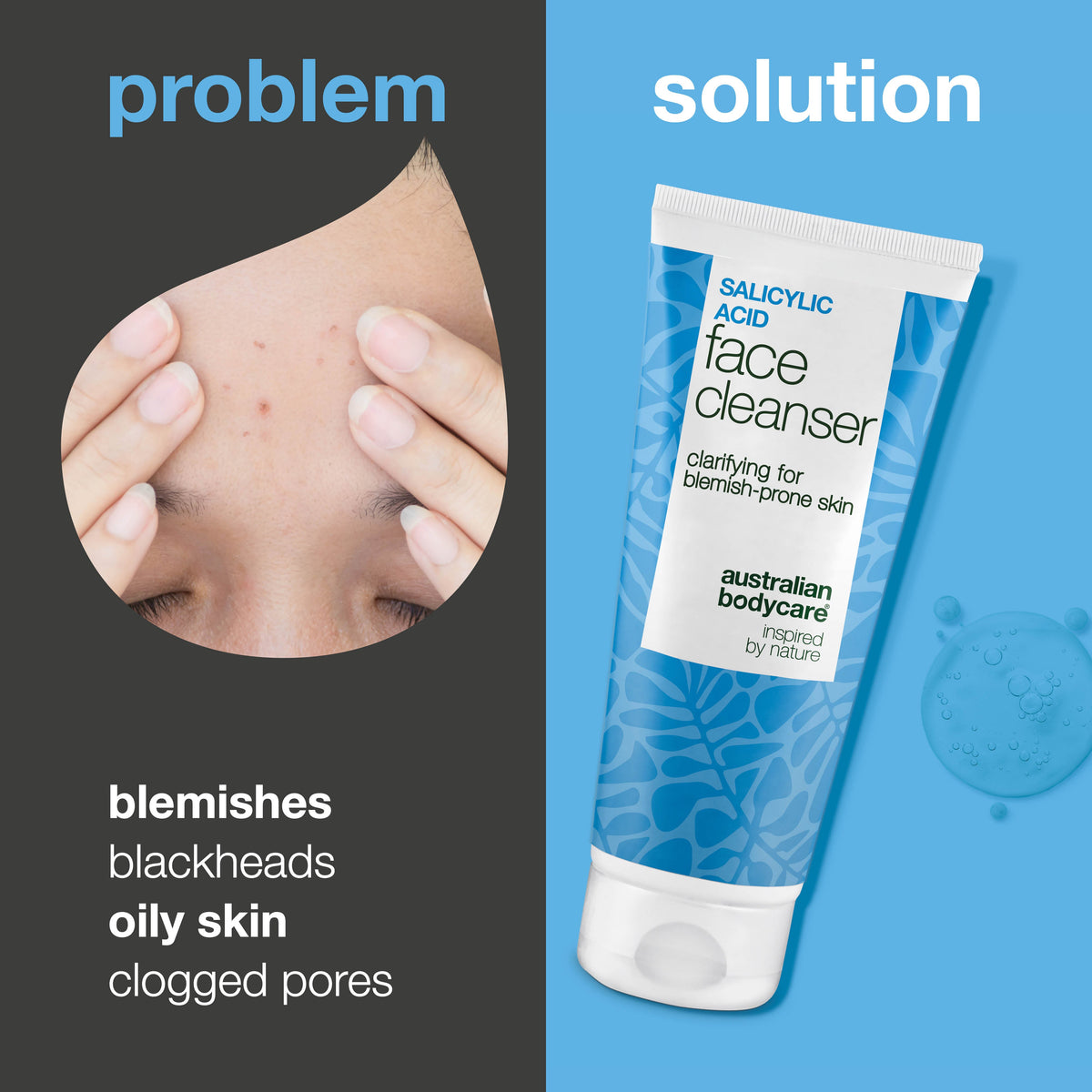 Salicylzuur Gezichtsreiniger tegen onzuiverheden — Salicylzuur Cleanser helpt tegen mee-eters, zuivert de huid en voorkomt verstopte poriën. Met Salicylzuur.