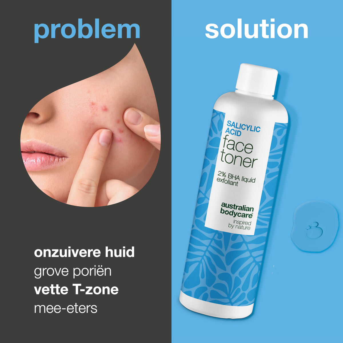 Salicylzuur-toner voor puistjes en vergrote poriën — Salicylzuur-exfoliant reinigt poriën, vermindert puistjes en verfijnt de huidstructuur. Perfect voor de dagelijkse verzorging.