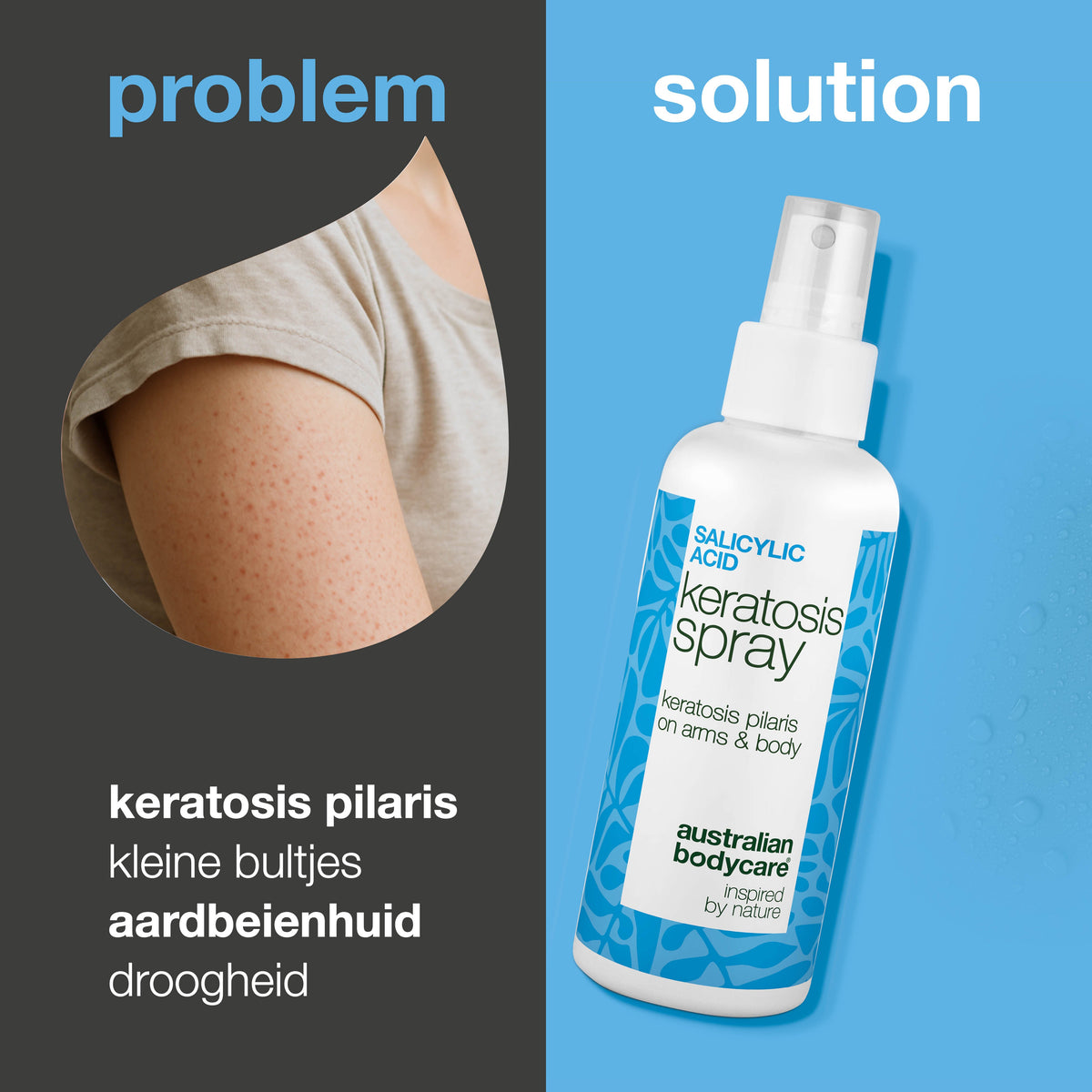 Keratosis pilaris spray tegen ruwe huid en bultjes — Keratosis pilaris spray vermindert ruwe bultjes en maakt de huid glad. Bevat salicylzuur voor diepe exfoliatie.