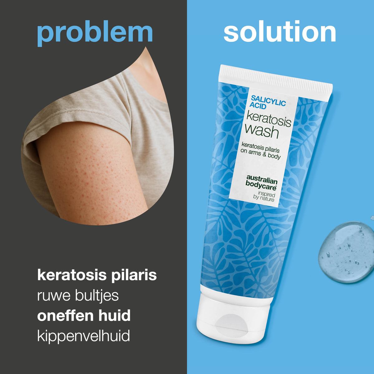 Keratosis Pilaris Douchegel – tegen ruwe en bobbelige huid — Keratosis Pilaris Body Wash tegen ruwe huid en bultjes door keratosis pilaris. Met salicylzuur, niacinamide en glycerine.