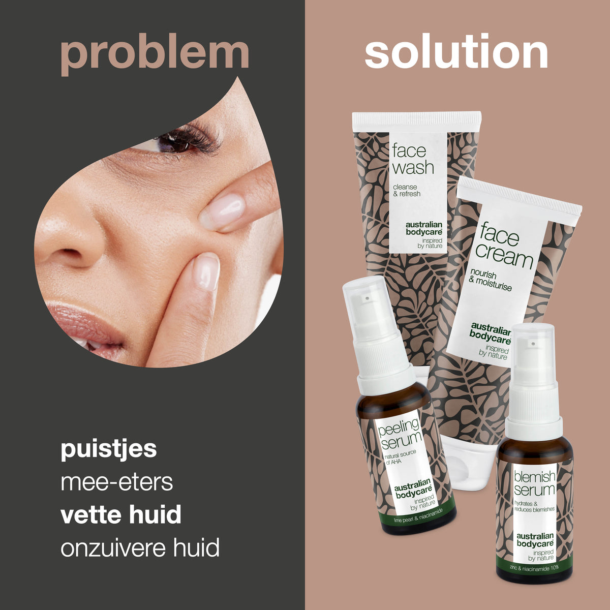 Anti Blemish Face Kit voor onzuivere huid en puistjes — Diepreinigende huidverzorging voor vette huid, puistjes en mee-eters