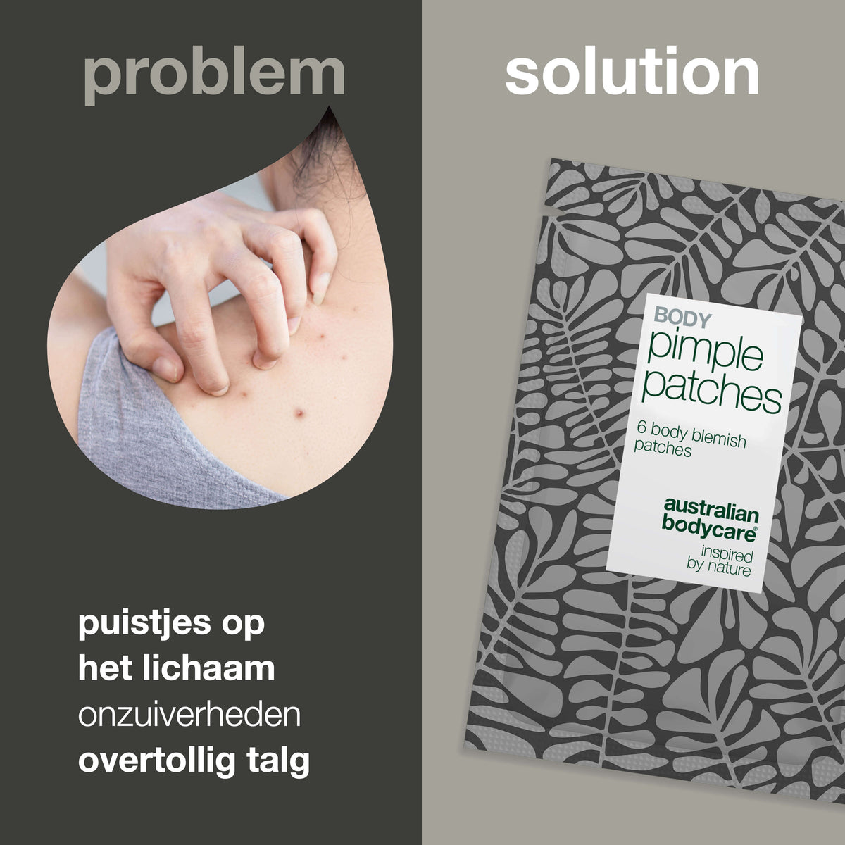 Body Pimple Patches – Behandeling voor puistjes op het lichaam — Effectieve puistenpleisters voor rug, borst en schouders. Absorbeert talg, beschermt de huid en vermindert onzuiverheden.
