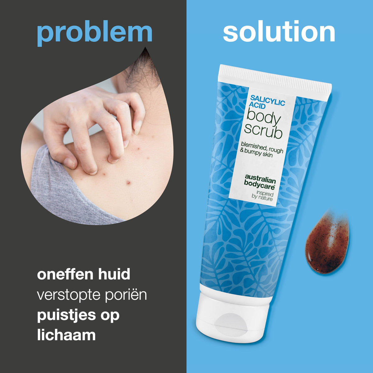 Lichaamsscrub met salicylzuur voor een zuivere en gladdere huid — Body Scrub met salicylzuur verwijdert puistjes en onzuiverheden. Bevat salicylzuur, glycolzuur, abrikozenpitpoeder en allantoïne.