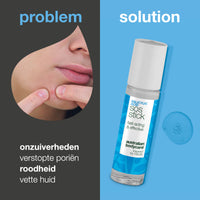 Salicylzuur SOS Stick tegen puistjes en verstopte poriën — Salicylzuur SOS Stick zuivert een vette, onzuivere huid. Helpt roodheid verminderen en huidbalans herstellen. Met Salicylzuur.