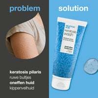 Keratosis Pilaris Douchegel – tegen ruwe en bobbelige huid — Keratosis Pilaris Body Wash tegen ruwe huid en bultjes door keratosis pilaris. Met salicylzuur, niacinamide en glycerine.